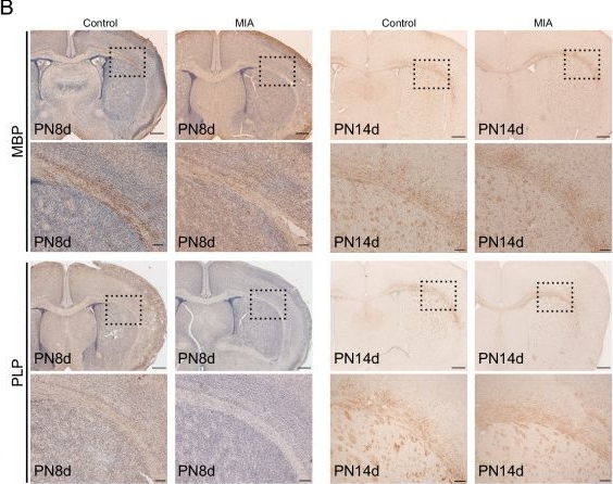 Fig.3.B showing Immunohistochemistry in a Mus musculus (House mouse) sample from the publication: Prenatal inflammation impairs early CD11c-positive microglia induction and delays myelination in neurodevelopmental disorders.