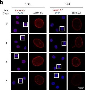 Fig.1.B showing Immunocytochemistry-immunofluorescence from the publication: Nuclear Lamina Dysfunction and DNA Damage as Drivers of Premature Senescence in a Human Müller Glial Cell Model of Spinocerebellar Ataxia Type 7.