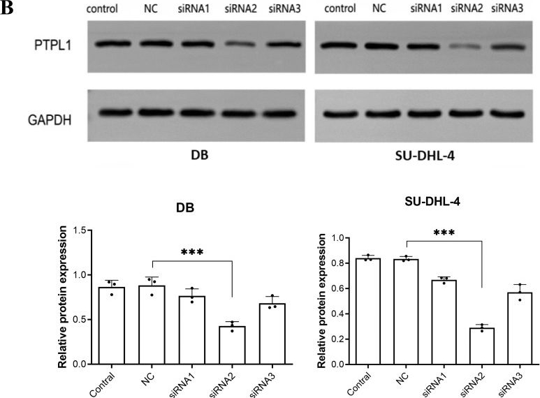 Fig.1.B showing Western Blotting in a Homo sapiens (Human) sample from the publication: Arsenic disulfide promoted the demethylation of PTPL1 in diffuse large B cell lymphoma cells.
