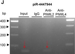 Fig.5.J showing Western Blotting from the publication: PiRNA-4447944 promotes castration-resistant growth and metastasis of prostate cancer by inhibiting NEFH expression through forming the piRNA-4447944-PIWIL2-NEFH complex.