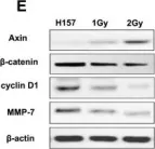 Fig.3.E showing Western Blotting from the publication: Axin gene methylation status correlates with radiosensitivity of lung cancer cells.