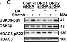 Fig.6.C showing Western Blotting in a Homo sapiens (Human) sample from the publication: DRD1 downregulation contributes to mechanical stretch-induced lung endothelial barrier dysfunction.