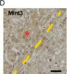 Fig.1.D showing Immunohistochemistry from the publication: Mint3 as a Molecular Target Activated in the Early Stage of Hepatocarcinogenesis.