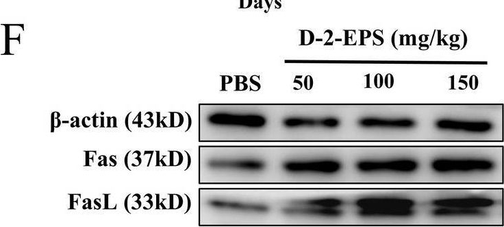 Fig.5.F showing Western Blotting from the publication: The anticancer mechanisms of exopolysaccharide from Weissella cibaria D-2 on colorectal cancer via apoptosis induction.