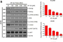 Fig.1.B showing Western Blotting in a Homo sapiens (Human) sample from the publication: ATM inhibitor KU60019 synergistically sensitizes lung cancer cells to topoisomerase II poisons by multiple mechanisms.