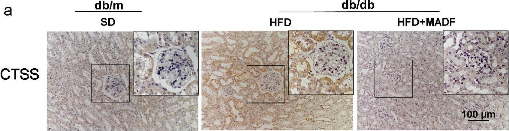 Fig.6.A showing Immunohistochemistry in a Mus musculus (House mouse) sample from the publication: Proteomic and metabolomic profiling reveals the underlying molecular mechanisms in modified alternate-day fasting-mediated protection against Diabetic kidney disease.