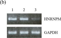 Fig.1.B showing Western Blotting in a Homo sapiens (Human) sample from the publication: Alterations in Glucose Metabolism Due to Decreased Expression of Heterogeneous Nuclear Ribonucleoprotein M in Pancreatic Ductal Adenocarcinoma.