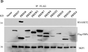 Fig.2.D showing Western Blotting from the publication: FBXO6-mediated RNASET2 ubiquitination and degradation governs the development of ovarian cancer.