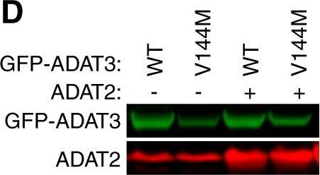 Fig.9.D showing Western Blotting in a Homo sapiens (Human) sample from the publication: Formation of tRNA Wobble Inosine in Humans Is Disrupted by a Millennia-Old Mutation Causing Intellectual Disability.