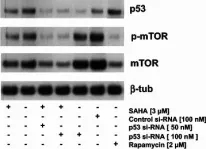 Fig.7.A showing Western Blotting in a Homo sapiens (Human) sample from the publication: Molecular mechanism leading to SAHA-induced autophagy in tumor cells: evidence for a p53-dependent pathway.