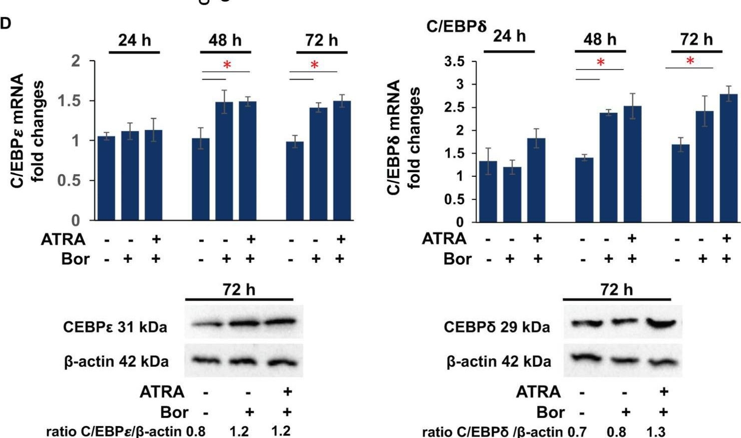 Fig.1.D showing Western Blotting in a Homo sapiens (Human) sample from the publication: YY1 Knockdown Relieves the Differentiation Block and Restores Apoptosis in AML Cells.