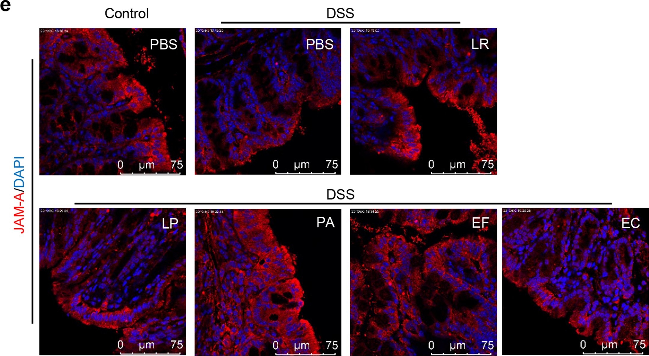 Fig.3.E showing Immunohistochemistry-immunofluorescence from the publication: Human-derived bacterial strains mitigate colitis via modulating gut microbiota and repairing intestinal barrier function in mice.