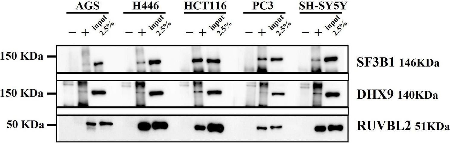 Fig.6.A showing Western Blotting in a Homo sapiens (Human) sample from the publication: Characterization of the interactome profiling of Mycoplasma fermentans DnaK in cancer cells reveals interference with key cellular pathways.