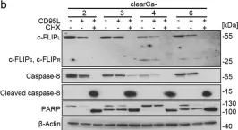 Fig.2.B showing Western Blotting from the publication: c-FLIP and CD95 signaling are essential for survival of renal cell carcinoma.