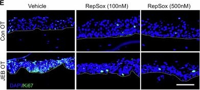 Fig.4.E showing Immunohistochemistry-immunofluorescence from the publication: Dermal papillary fibroblasts promote persistent granulation tissue formation in junctional epidermolysis bullosa.