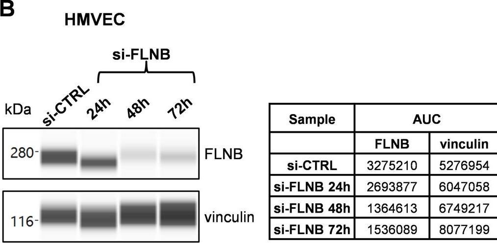 Fig.5.B showing Western Blotting in a Homo sapiens (Human) sample from the publication: Extracellular vesicles produced by irradiated endothelial or Glioblastoma stem cells promote tumor growth and vascularization modulating tumor microenvironment.