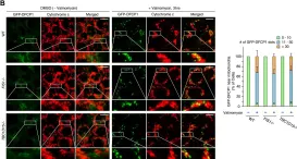 Fig.2.B showing Immunocytochemistry-immunofluorescence from the publication: Mitochondrial Rab GAPs govern autophagosome biogenesis during mitophagy.