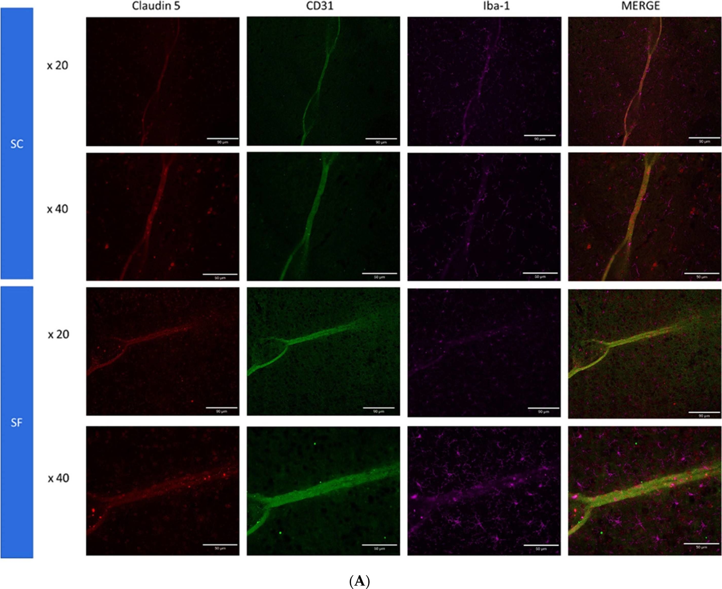 Fig.5.A showing Immunohistochemistry-immunofluorescence in a Mus musculus (House mouse) sample from the publication: Cognitive Impairments, Neuroinflammation and Blood-Brain Barrier Permeability in Mice Exposed to Chronic Sleep Fragmentation during the Daylight Period.