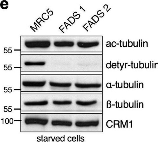 Fig.4.E showing Western Blotting from the publication: Centrosome and ciliary abnormalities in fetal akinesia deformation sequence human fibroblasts.
