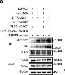 Fig.2.Q showing Western Blotting in a Homo sapiens (Human) sample from the publication: HDAC7 drives glioblastoma to a mesenchymal-like state via LGALS3-mediated crosstalk between cancer cells and macrophages.
