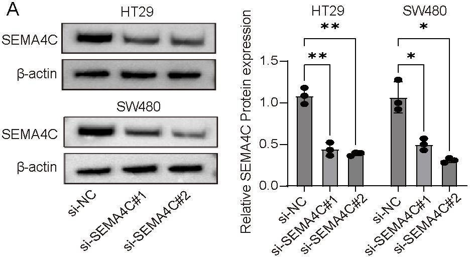 Fig.9.A showing Western Blotting from the publication: Integrative analysis of semaphorins family genes in colorectal cancer: implications for prognosis and immunotherapy.