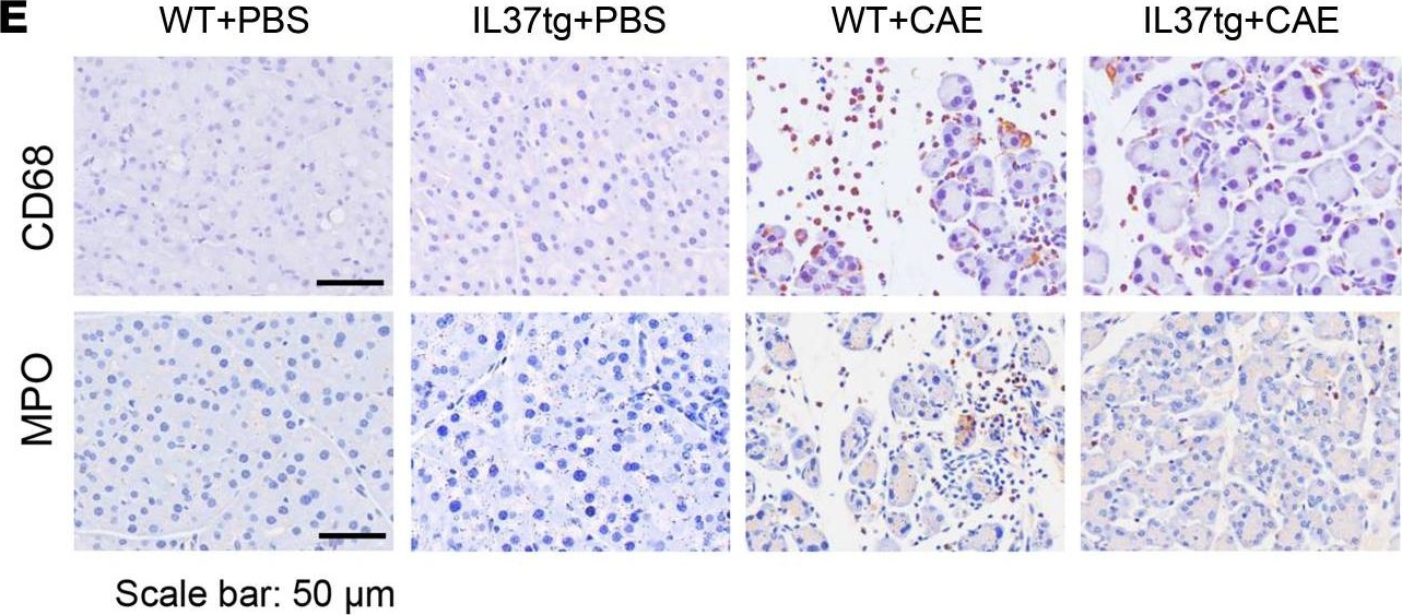 Fig.2.E showing Immunohistochemistry in a Mus musculus (House mouse) sample from the publication: Interleukin-37 protects against acinar cell pyroptosis in acute pancreatitis.