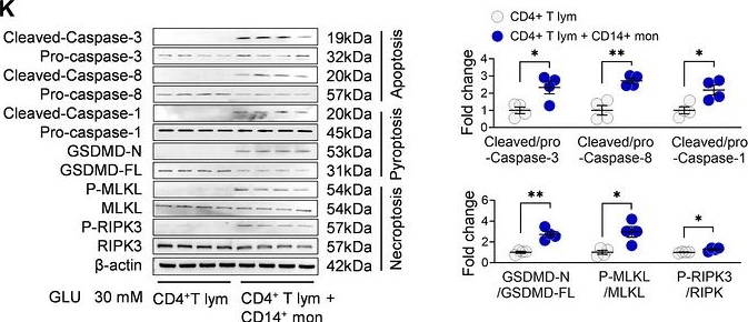 Fig.7.K showing Western Blotting in a Homo sapiens (Human) sample from the publication: Stress Hyperglycemia Drives CD4+ T Cell PANoptosis and Postoperative Organ Injury via Monocyte-Derived Succinate.