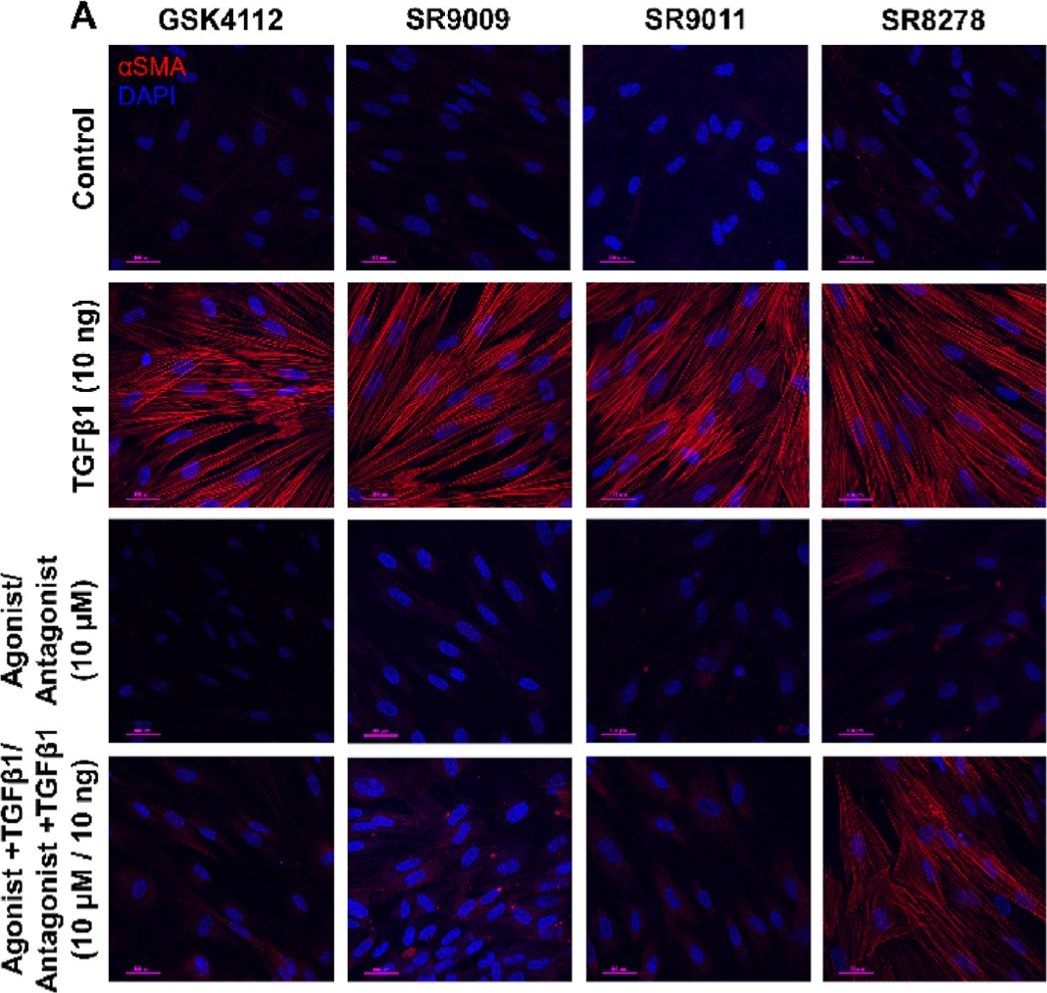 Fig.2.A showing Immunocytochemistry-immunofluorescence from the publication: Rev-erbα agonists suppresses TGFβ1-induced fibroblast-to-myofibroblast transition and pro-fibrotic phenotype in human lung fibroblasts.