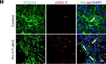 Fig.6.H showing Immunohistochemistry-immunofluorescence in a Mus musculus (House mouse) sample from the publication: PIEZO1 mediates periostin+ myofibroblast activation and pulmonary fibrosis in mice.