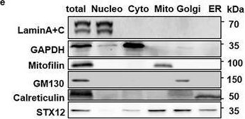 Fig.3.E showing Western Blotting from the publication: Rapamycin Alleviates Heart Failure Caused by Mitochondrial Dysfunction and SERCA Hypoactivity in Syntaxin 12/13 Deficient Models.