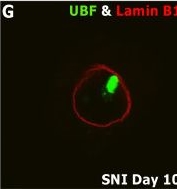 Fig.3.G showing Immunocytochemistry-immunofluorescence in a Rattus norvegicus (Rat) sample from the publication: miR-30c-5p Gain and Loss of Function Modulate Sciatic Nerve Injury-Induced Nucleolar Stress Response in Dorsal Root Ganglia Neurons.