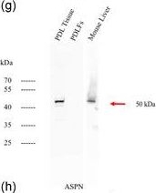 Fig.7.G showing Western Blotting in a Homo sapiens (Human) sample from the publication: The profiling and analysis of gene expression in human periodontal ligament tissue and fibroblasts.