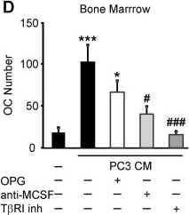 Fig.4.D showing Blocking experiments in a Homo sapiens (Human) sample from the publication: Molecular signaling pathways mediating osteoclastogenesis induced by prostate cancer cells.
