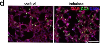 Fig.6.D showing Immunohistochemistry-immunofluorescence in a Homo sapiens (Human) sample from the publication: Modulation of p-eIF2α cellular levels and stress granule assembly/disassembly by trehalose.