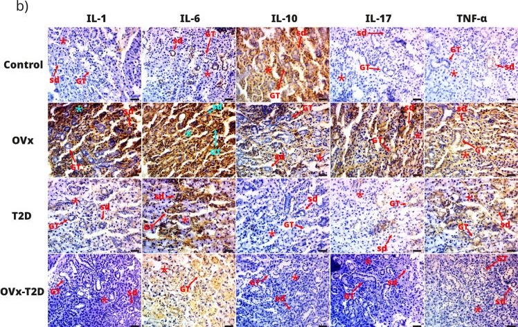 Fig.4.B showing Immunohistochemistry from the publication: Estrogen deficiency due to type 2 diabetes induced hyposalivation in female mice by promoting inflammation in the salivary glands.