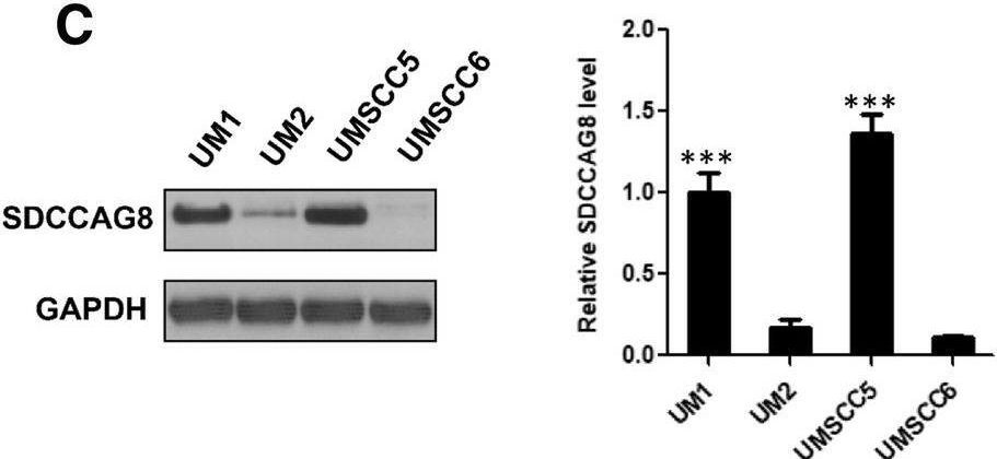 Fig.4.C showing Western Blotting in a Homo sapiens (Human) sample from the publication: Sox11 promotes head and neck cancer progression via the regulation of SDCCAG8.