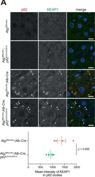 Fig.1.A showing Immunocytochemistry-immunofluorescence in a Mus musculus (House mouse) sample from the publication: KEAP1 retention in phase-separated p62 bodies drives liver damage under autophagy-deficient conditions.