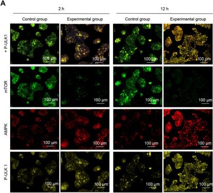 Fig.4.A showing Immunocytochemistry-immunofluorescence in a Homo sapiens (Human) sample from the publication: Keratinocyte Autophagy-Mediated Self-Assembling Tetrahedral Framework Nucleic Acid Induces Wound Healing and Reduces Scar Hyperplasia.