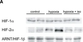 Fig.4.A showing Western Blotting from the publication: General anesthetics inhibit erythropoietin induction under hypoxic conditions in the mouse brain.