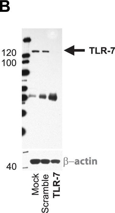 Fig.4.B showing Western Blotting in a Homo sapiens (Human) sample from the publication: HIV and HCV activate the inflammasome in monocytes and macrophages via endosomal Toll-like receptors without induction of type 1 interferon.