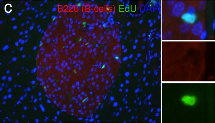 Fig.9.C showing Western Blotting in a Mus musculus (House mouse) sample from the publication: Resolving Discrepant Findings on ANGPTL8 in β-Cell Proliferation: A Collaborative Approach to Resolving the Betatrophin Controversy.