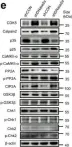 Fig.2.E showing Western Blotting from the publication: Neuronal double-stranded DNA accumulation induced by DNase II deficiency drives tau phosphorylation and neurodegeneration.