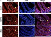 Fig.6.A showing Immunohistochemistry in a Rattus norvegicus (Rat) sample from the publication: A new murine ileostomy model: recycling stool prevents intestinal atrophy in the distal side of ileostomy.