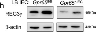 Fig.1.H showing Western Blotting from the publication: Intestinal epithelial pH-sensing receptor GPR65 maintains mucosal homeostasis via regulating antimicrobial defense and restrains gut inflammation in inflammatory bowel disease.