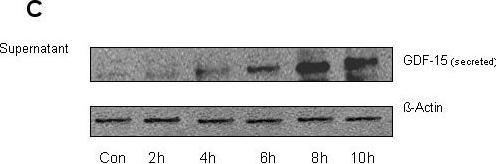 Fig.9.C showing Western Blotting in a Homo sapiens (Human) sample from the publication: GDF-15 is abundantly expressed in plexiform lesions in patients with pulmonary arterial hypertension and affects proliferation and apoptosis of pulmonary endothelial cells.