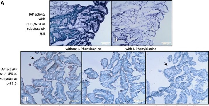 Fig.2.A showing Immunohistochemistry in a Homo sapiens (Human) sample from the publication: Necrotizing enterocolitis: a potential protective role for intestinal alkaline phosphatase as lipopolysaccharide detoxifying enzyme.