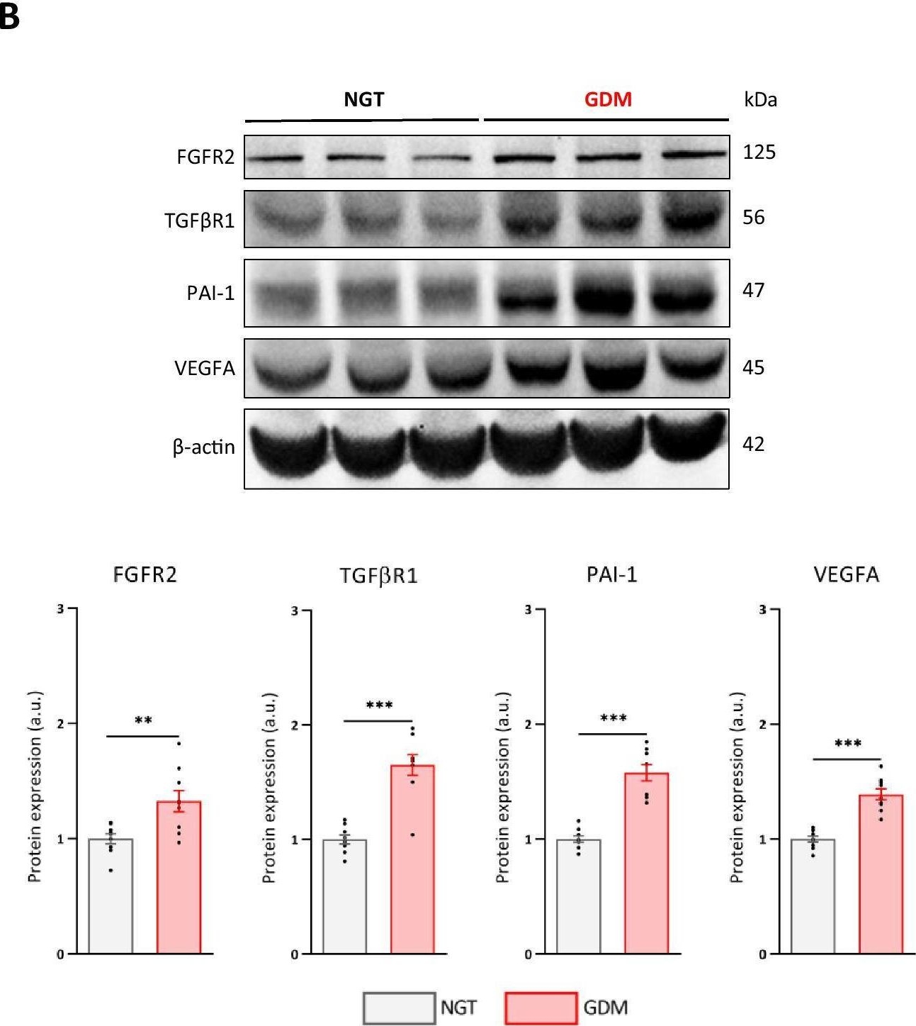 Fig.2.B showing Western Blotting in a Homo sapiens (Human) sample from the publication: The angiogenic properties of human amniotic membrane stem cells are enhanced in gestational diabetes and associate with fetal adiposity.