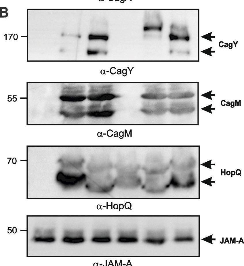 Fig.5.B showing Western Blotting in a Homo sapiens (Human) sample from the publication: Cultivation and molecular characterization of viable Helicobacter pylori from the root canal of 170 deciduous teeth of children.