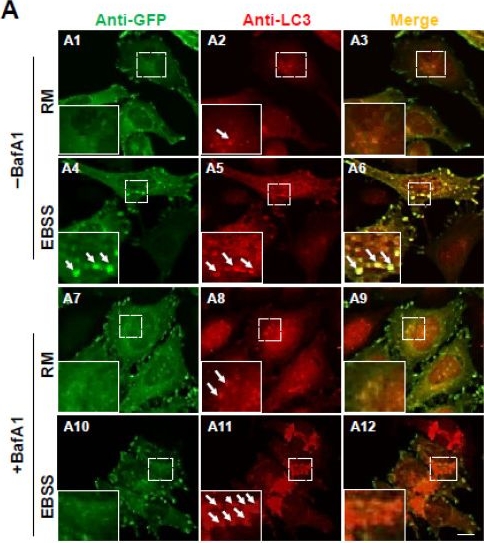Fig.3.A showing Immunocytochemistry-immunofluorescence from the publication: Tracking Focal Adhesion Turnover: A Novel Reporter for FA-Phagy Flux.