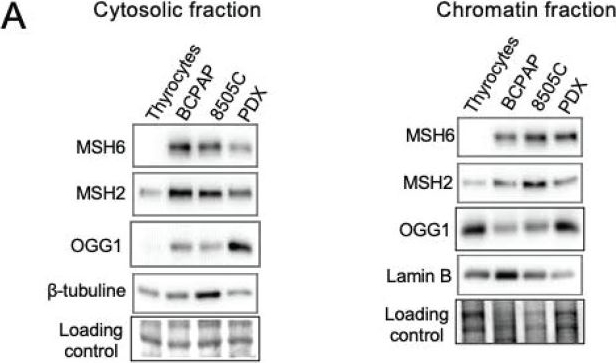 Fig.2.A showing Western Blotting from the publication: NOX4-derived oxidative DNA damage impairs thyroid differentiation through an epigenetic mechanism in BRAF-mutated radioactive iodine refractory papillary thyroid cancer cells.